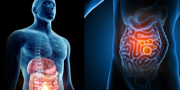 Što je i kako se čuva “gut health”?